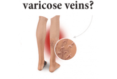 Varicose veins and hemorrhoids