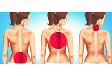 Боль в спине с симптомами в ногах