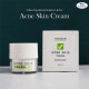 Acne Skin Cream  (Thaicream) - 15 g