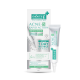 Smooth E Acne-5 Rapid Action Plus  (SMOOTH-E) - 10g.